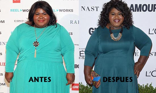 GaboureySidibe weightloossurgery